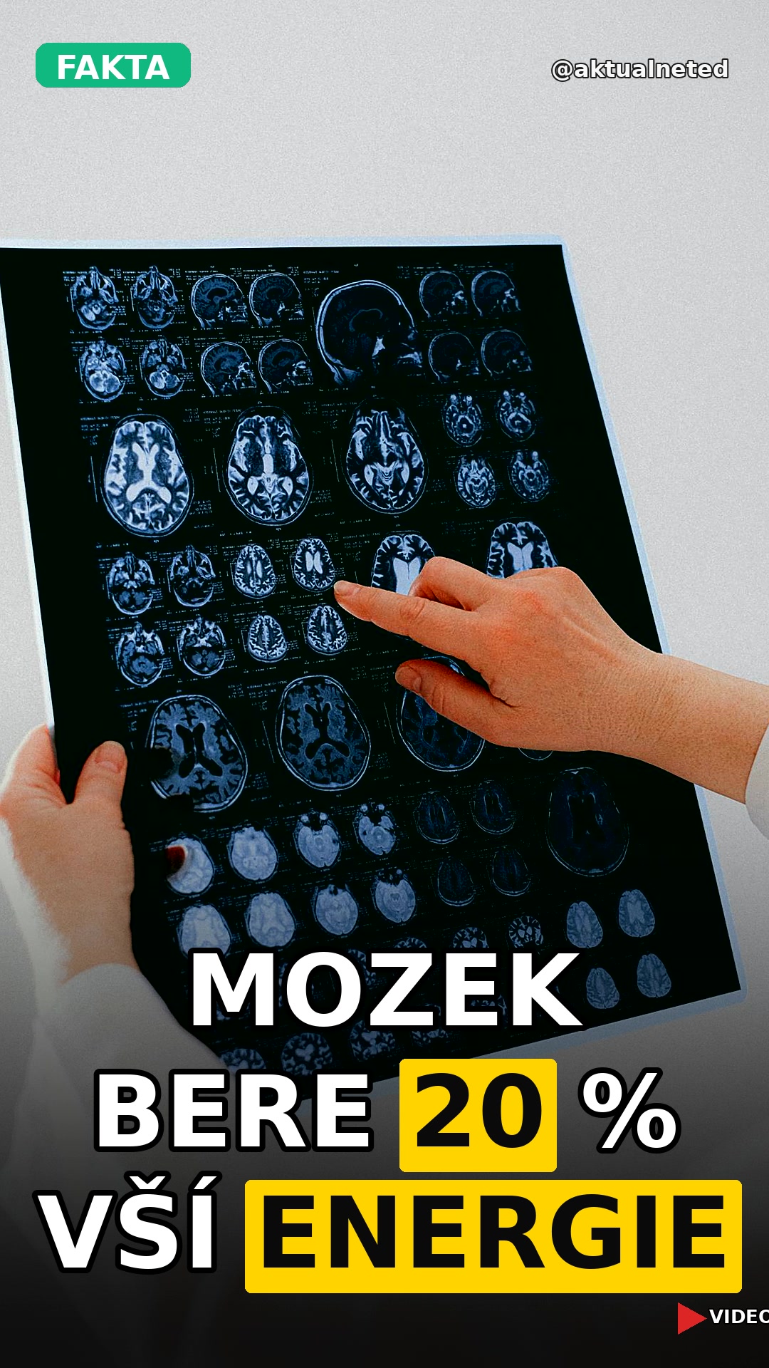 MOZEK BERE 20 % VŠÍ ENERGIE